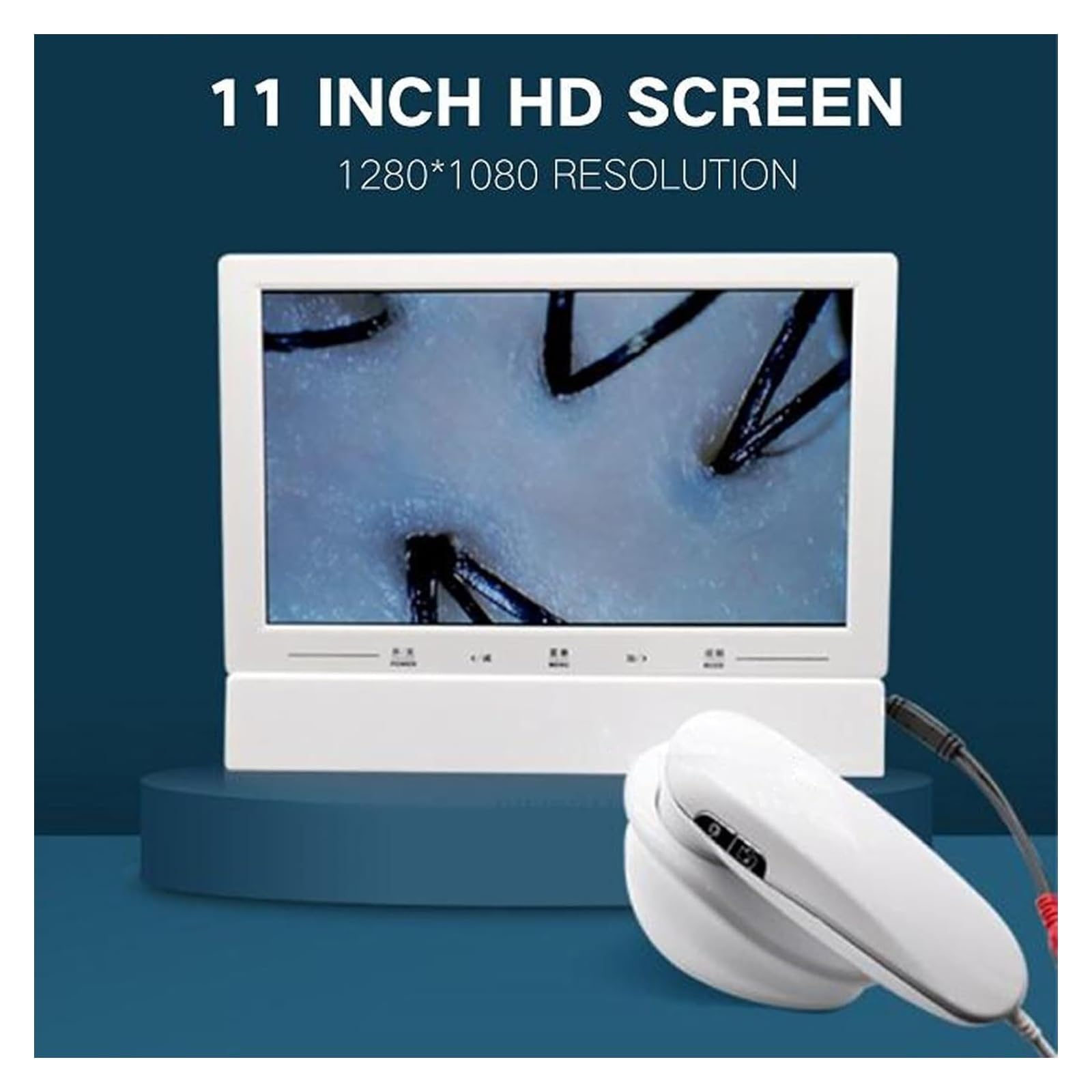 Haar- und Kopfhautanalysator, 11-Zoll-HD-Bildschirm, Kopfhautdetektor mit 1080P-Kamera, Haarfollikelöl-Feuchtigkeitsmikroskop-Tester, 1280 x 1080 Auflösung, Hautdiagnose-Tool mit 200X und 50X