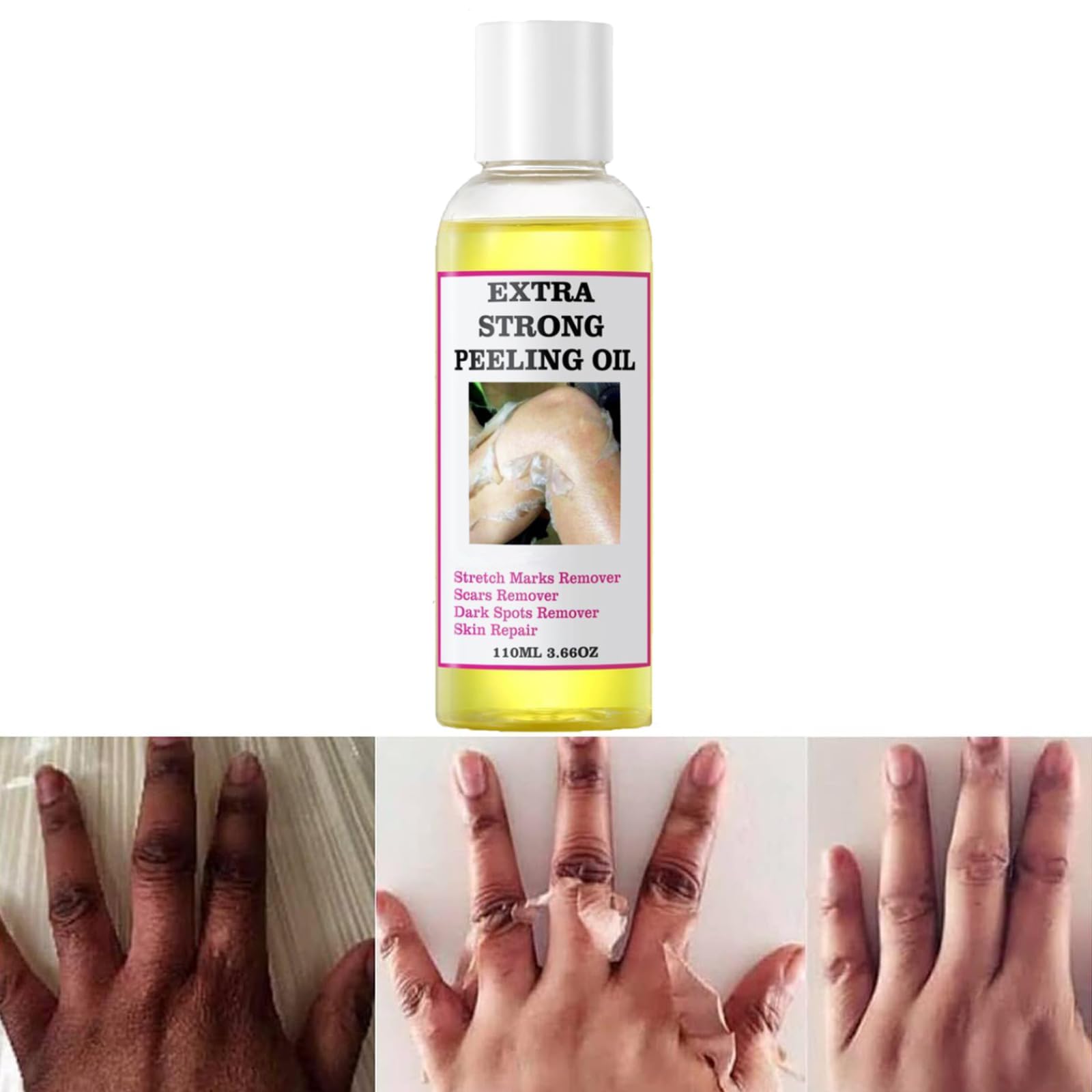 Peeling Oil, Extra Strong Peeling Oil, Yellow Peeling Oil for Dark Skin, Exfoliating Peeling Solution for Body, Hand, Feet and Face All Skin Type (110ML/3.88 Fl Oz)