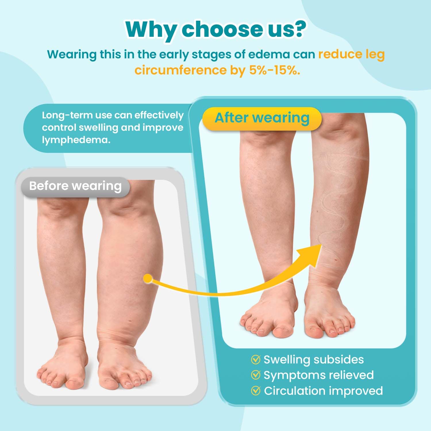 Sylong® Swelling Edema Calf Compression Wrap Adjustable Sleeve For Lower Leg Lymphedema Circulation (XL) - Image 5