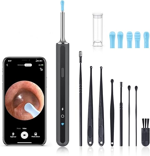 Miniatura 8 de Eliminación de cera de oídos, limpiador de oídos, kit de eliminación de cera de oídos con 1080P, otoscopio de cámara de oídos con luz, kit