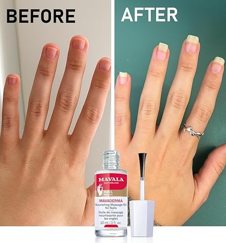 Miniatura 2 de Mavala Mavaderma - Aceite nutritivo de masaje para uñas, cuidado de uñas, endurecedor de uñas, aceite de cutícula, tratamiento hidratante y curativo