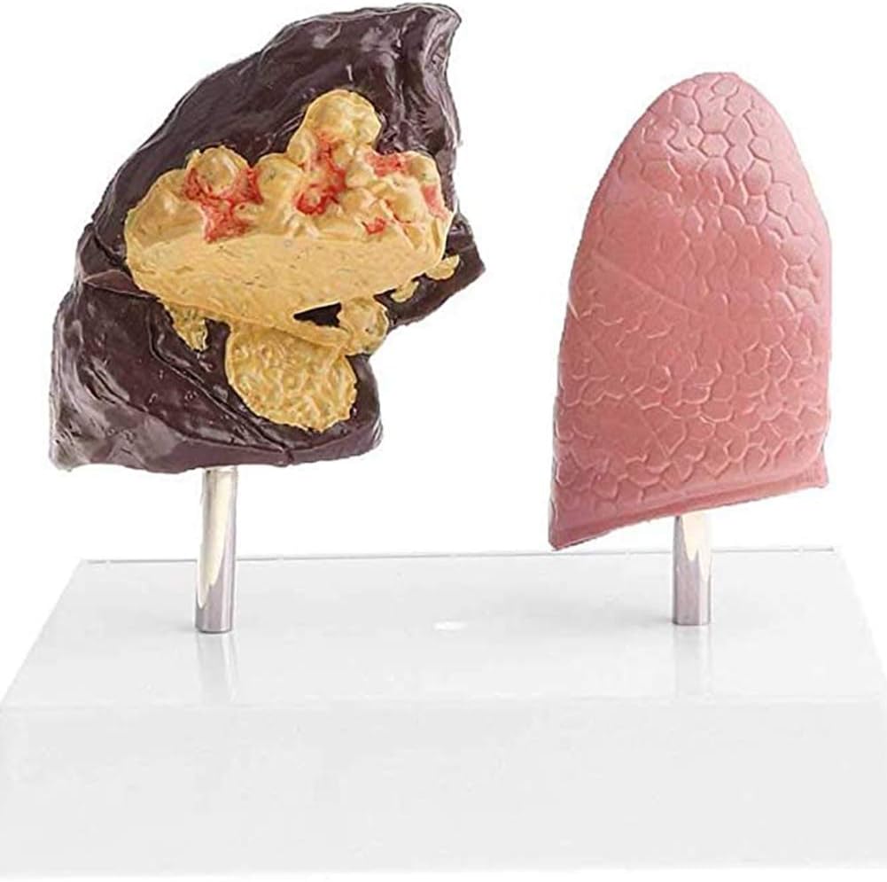 Dbscd Human Healthy Lungs And Pathological Lungs Comparison Model ...