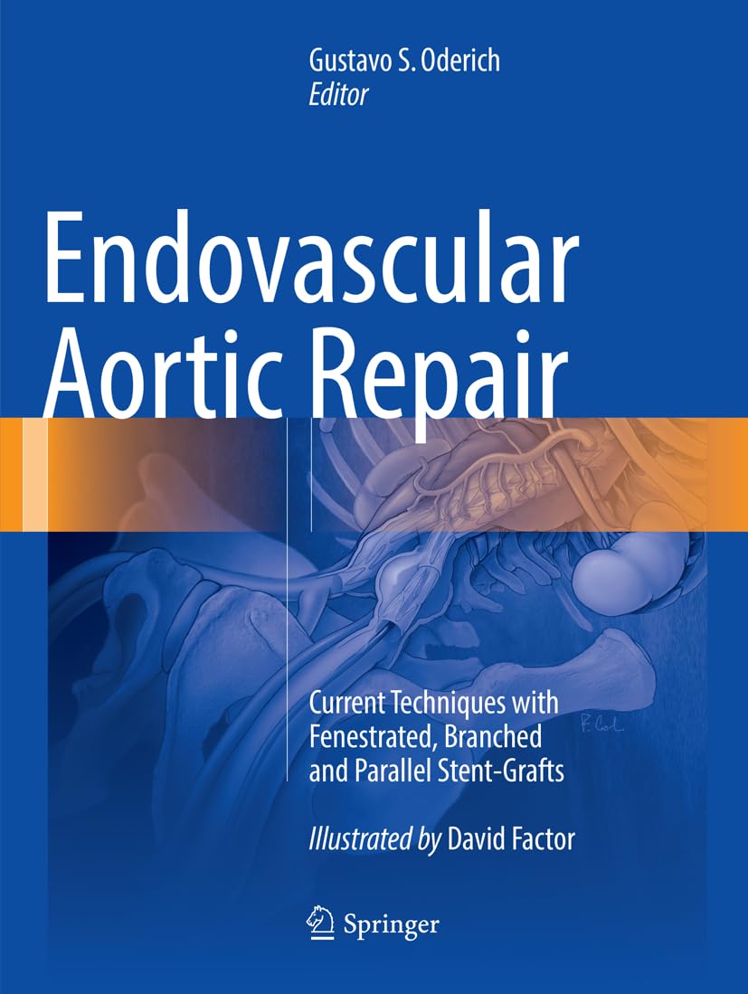 Endovascular Aortic Repair: Current Techniques with Fenestrated ...