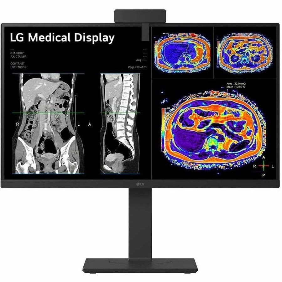 Image of LG 27HS713C-B 27 inch Class Webcam 4K UHD LED Monitor - 16:9 - Black