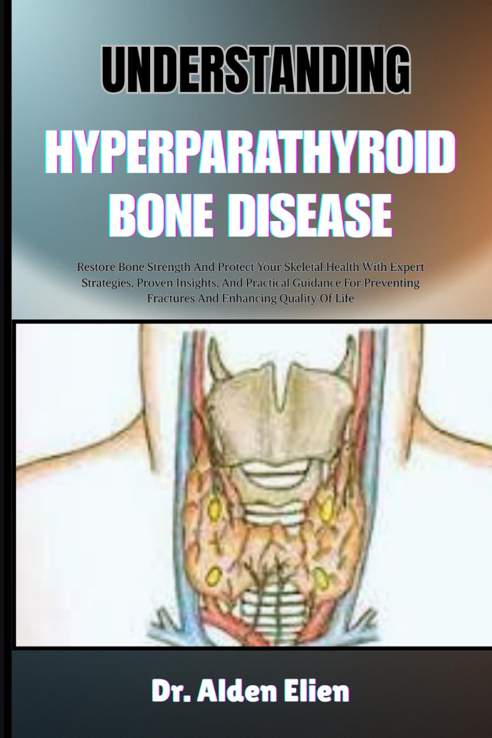 UNDERSTANDING HYPERPARATHYROID BONE DISEASE: Restore Bone Strength And Protect Your Skeletal Health With Expert Strategies, Proven Insights, And ... Fractures And Enhancing Quality Of Life