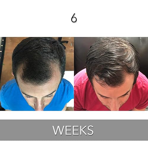 Miniatura 2 de Acondicionador de crecimiento del cabello de la vitamina de la biotina-(alta potencia) acondicionador de biotina para el crecimiento más rápido del