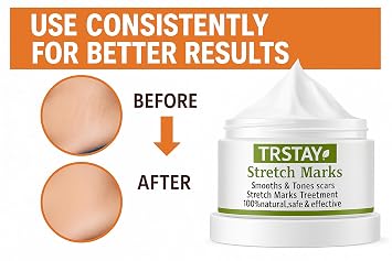 TRSTAY Stretch Mark Cream- 100% Natural Formula- With Vitamin E, Glycerin, Grape Seed Extract, and Neutropeptides (15, Grams)
