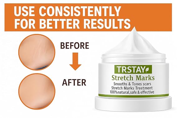 TRSTAY Stretch Mark Cream- 100% Natural Formula- With Vitamin E, Glycerin, Grape Seed Extract, and Neutropeptides (15, Grams)
