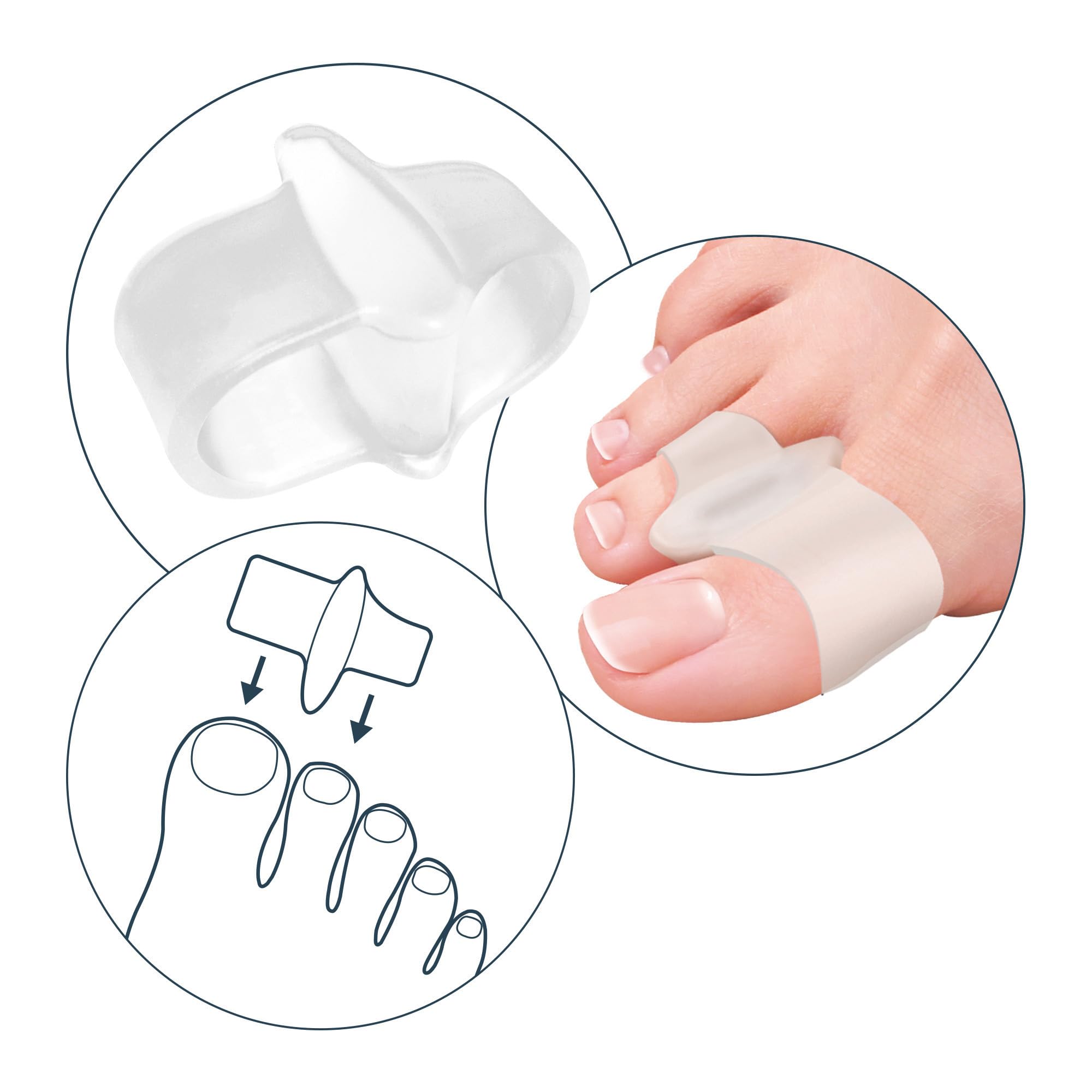 Tecniwork Allux Care Separatore E Divaricatore Per Alluce A Doppio Anello