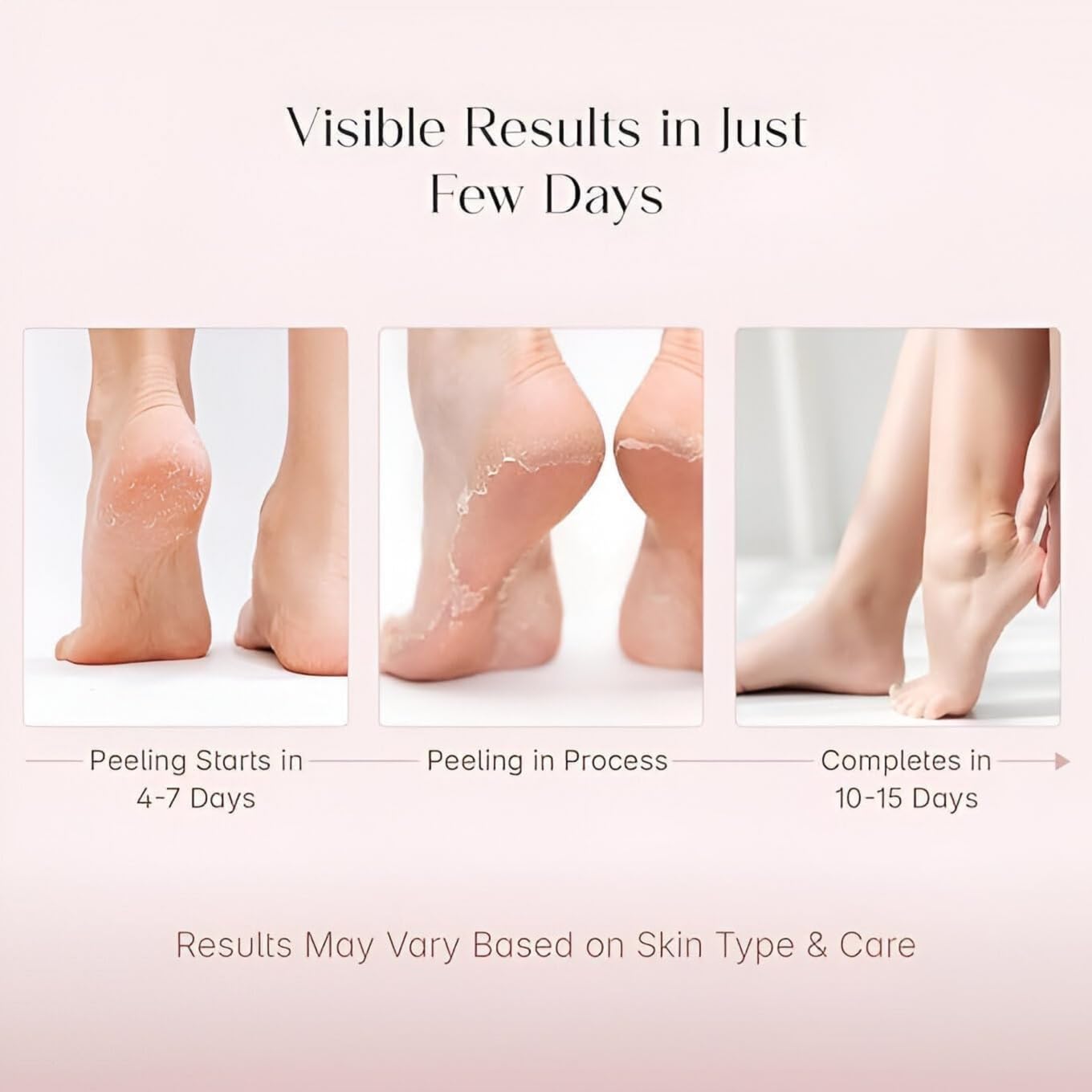 MOBDESK 2PCS Lavender Exfoliating Foot Mask for Dry & Cracked Feet β Foot Peel Mask with Natural Lavender Essence, Removes Dead Skin & Calluses, Moisturizing Foot Care Treatment for Soft Smooth Feet 2