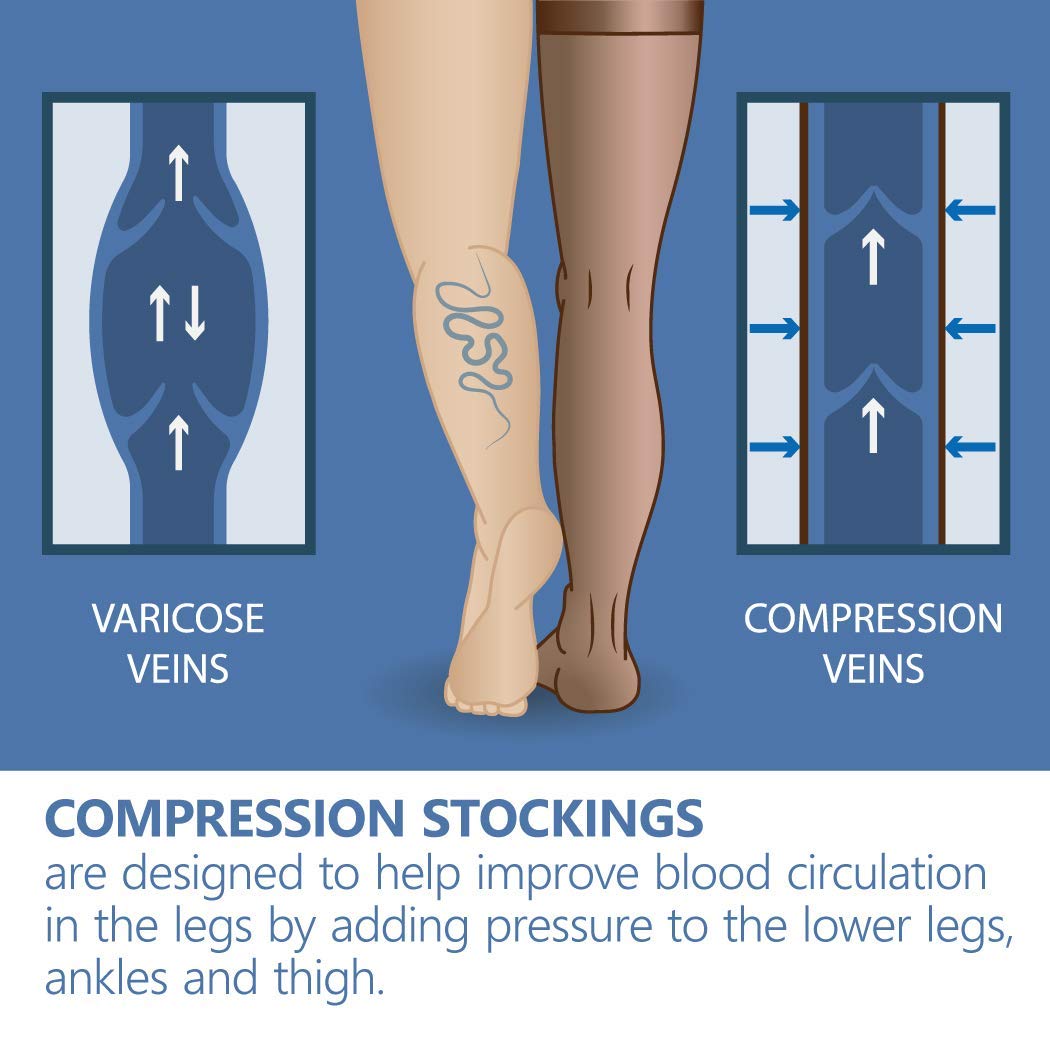 Bas de contention Elastiques Compression graduée à bout ouvert (classe médicale 2, 23-32 mmHG) pour femmes hommes Anti-thrombose Beige X-Large