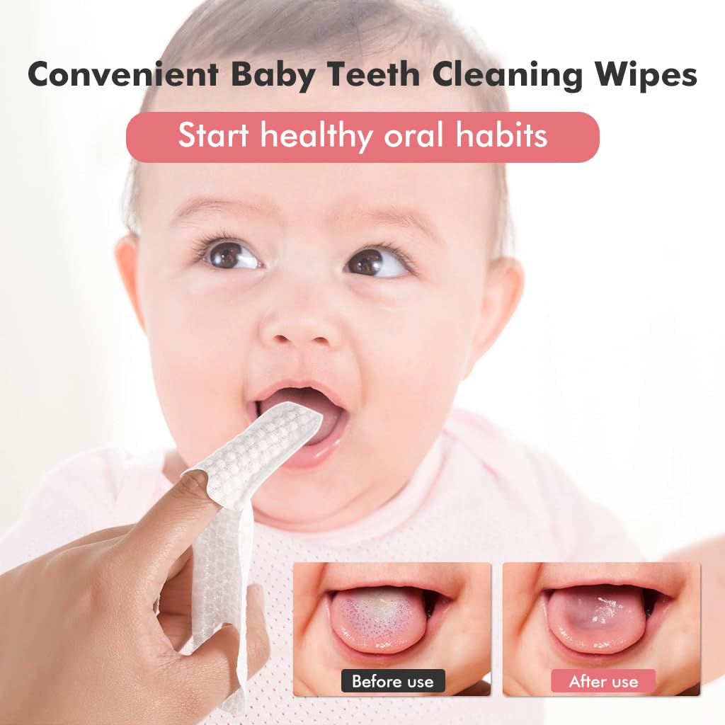 SNOWIE SOFT® 30Pcs Baby Teeth Cleaning Wipes Gum Friendly, Soft Finger-Cot Design with Anti-Slip Loop 30 Individually Sealed Wipes for Babies 0-24 Months Baby Oral Care Essentials 2 618bwsB33wL. SL1024