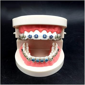 Amazon Co Jp 歯科矯正モデル 歯科歯の研究教育モデル 歯科矯正用金属ブラケット付きの歯モデル28歯 研究用ディスプレイ教育医療モデル スポーツ アウトドア