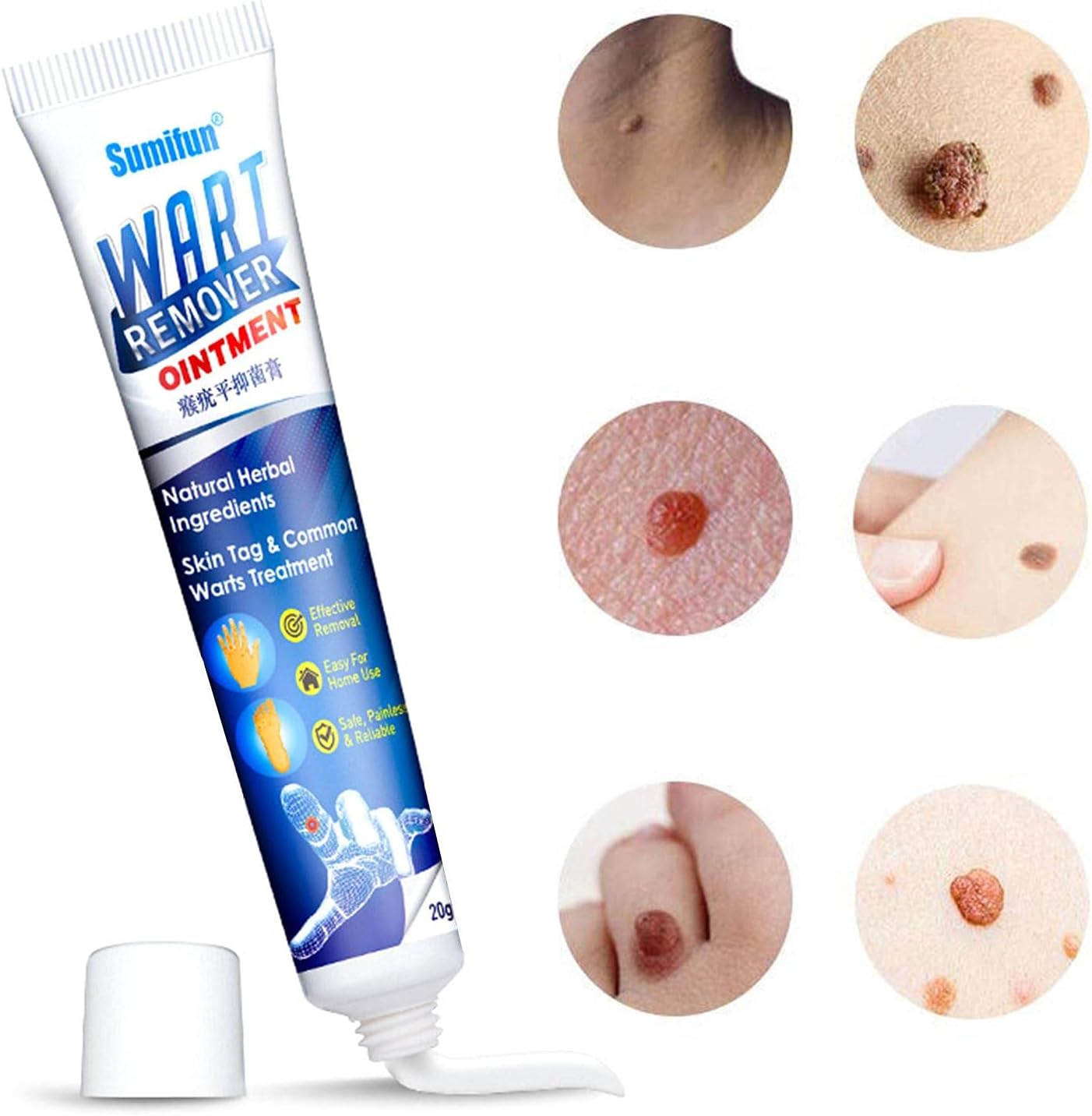 Amazon Co Jp Kmdj 顔イボ取り 薬 疣贅クリーム イボ 除去 薬用イボ取りクリーム ピーリングスムーサー 保湿ジェル g ビューティー