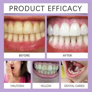 Teeth Whitening,Teeth Whitening Gel,3 PCS Gentle Teeth Whitening Gel Refills (3x3ml) Enamel-Friendly Formula with 35% Peppermint Extract,Brightens Smile & Adds Shine, Safe for Daily Care