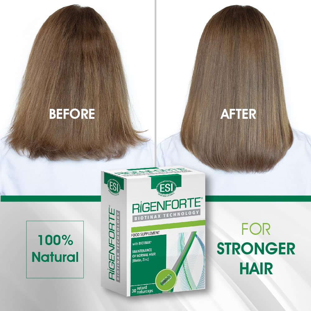 Rigenforte Hair Supplement, 30 Naturcaps- Biotinax Formula with Biotin, Zinc, Copper, Vit E & Selenium, Slow Release, Natural Ingredients, Reduces Hair Loss & Boosts Elasticity