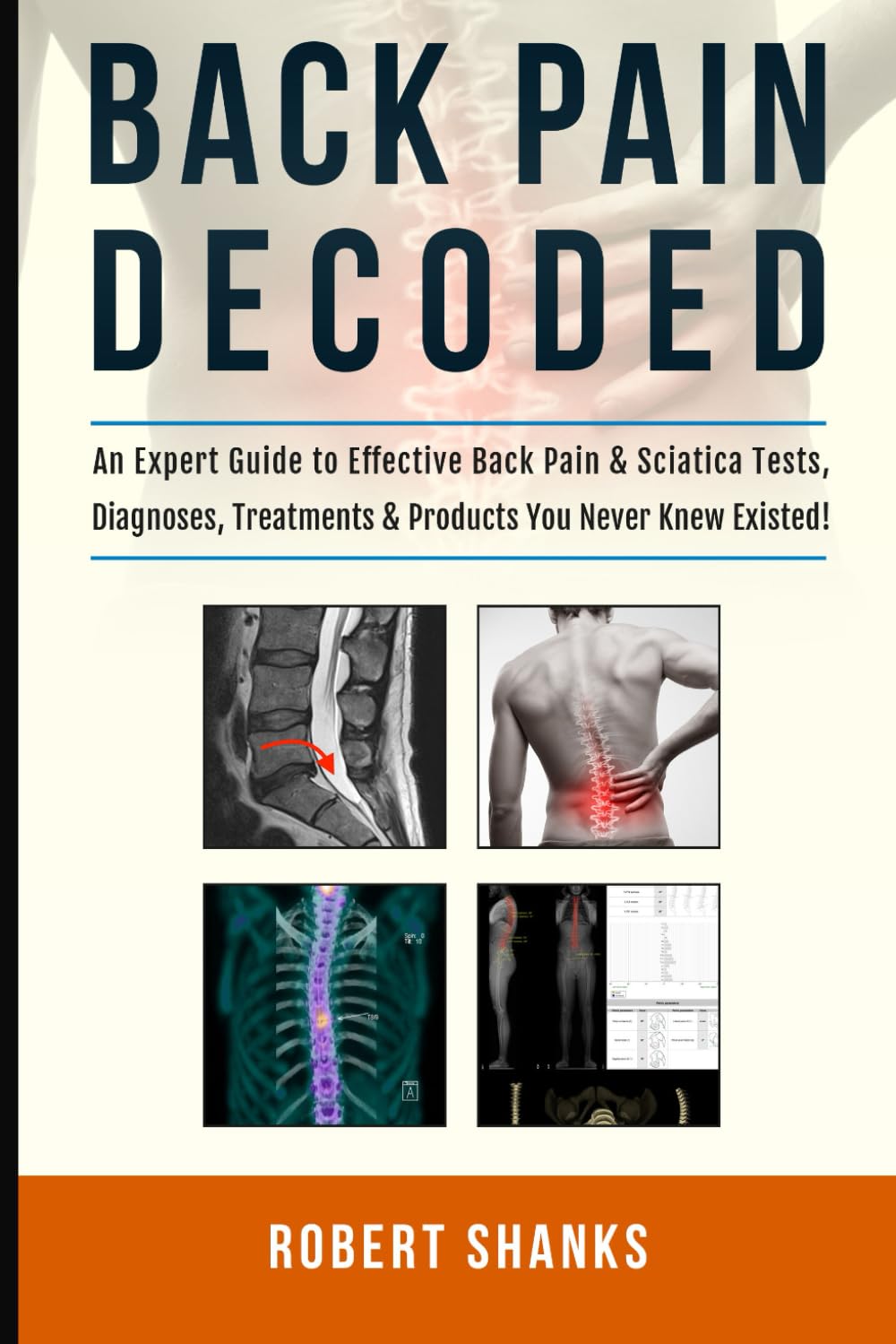 BACK PAIN DECODED: (Black & White) An Expert Guide to Effective Back Pain & Sciatica Tests, Diagnoses, Treatments & Products You Never Knew Existed!