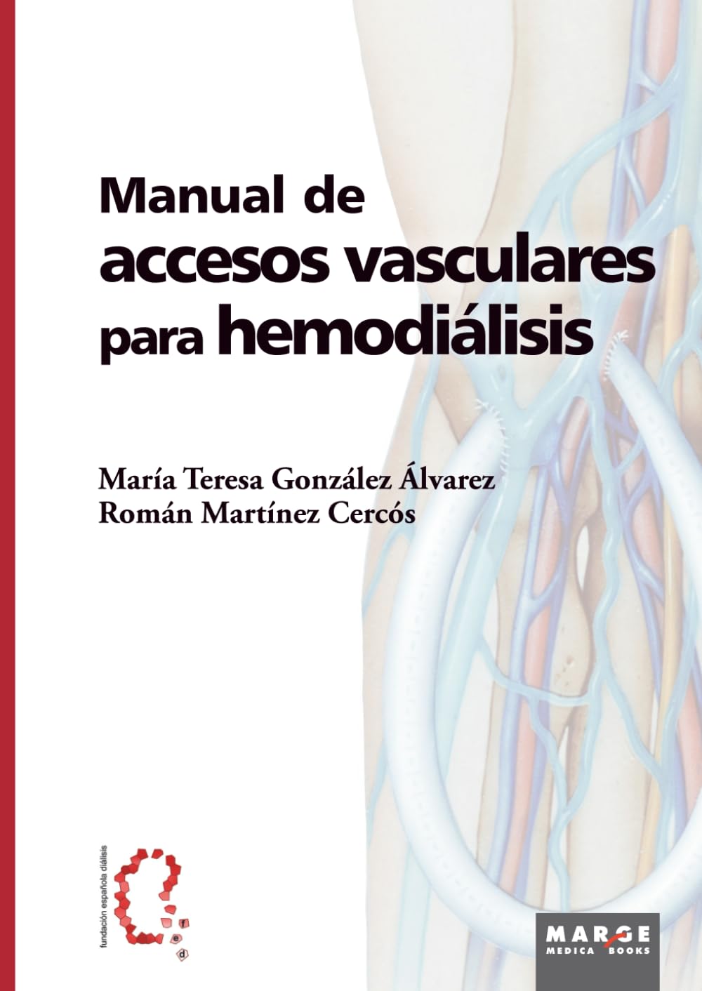 Manual de accesos vasculares para hemodiálisis (Medicina y Ciencias de la Salud)