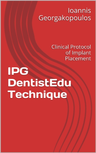 IPG DentistEdu Technique: Clinical Protocol of Implant Placement (English Edition)