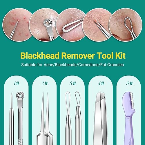 Miniatura 2 de TsMADDTs Kit de herramientas para reventar espinillas, 6 herramientas para eliminar puntos negros para cara y nariz, kit de depilación encarnada con