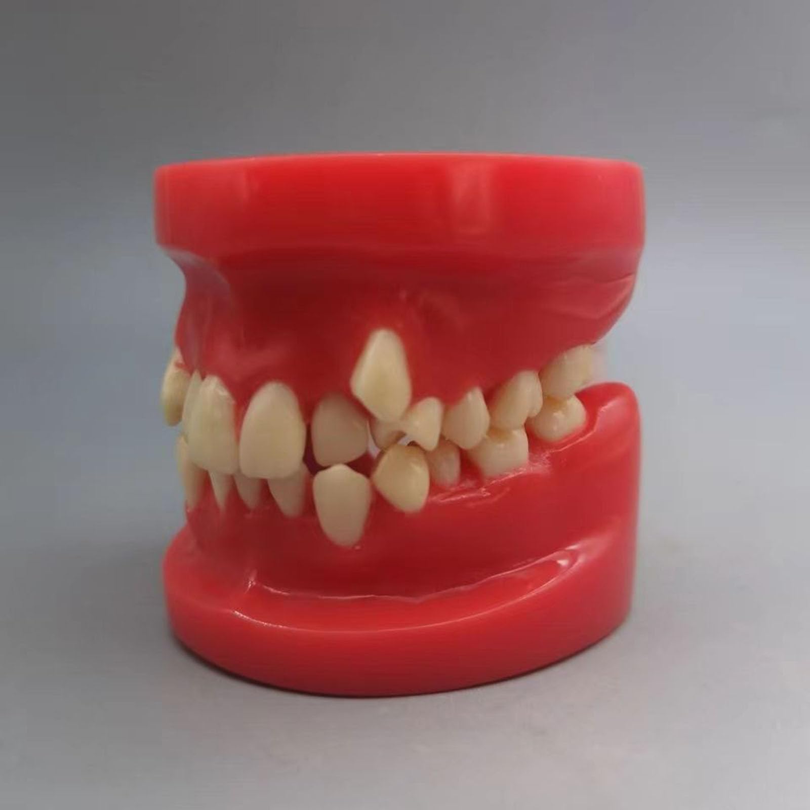 Kieferorthopädisches Demonstrationsmodell - Typodonten Kieferorthopädisches Demonstrationsmodell - Ideal für Bildungs- und Ausbildungszwecke,A,8cm
