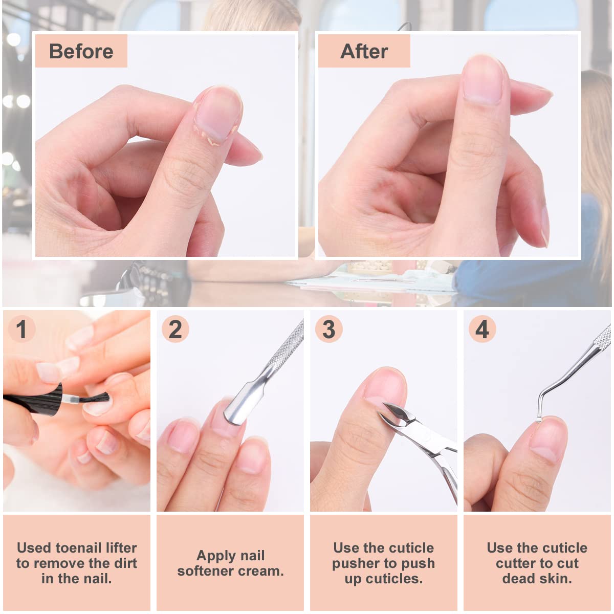 ACWOO Taglia Cuticole Professionale, 4 Pezzi Tronchesi per Cuticole, Tronchese Unghie Acciaio Inox per Unghie Incarnite Spesse Dure, Kit di Strumenti per Manicure con Spingi Cuticole (d'argento)