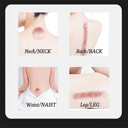 Miniatura 5 de Masajeador eléctrico de terapia de ventosas al vacío, masajeador de succión dinámica de mano con calefacción de 9 velocidades, ventosas