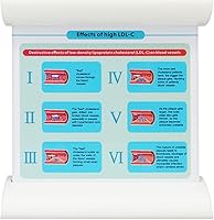 Vista 2 de Medarchitect Modelo de vaso sanguíneo LDL de la lipoproteína de baja densidad para la enseñanza del médico del paciente médico