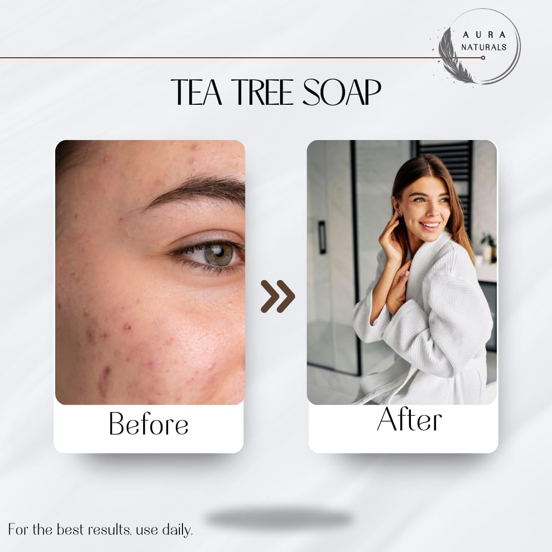 Aura Naturals Tea Tree Soap Bar - Set of 2, Natural Soap Bar for Face & Body Wash, Tea Tree Oil Soap with Anti Fungal Properties for Body Itching Acne Athlete's Foot Folliculitis 5