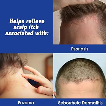 Scalpicin Scalp Itch Relief, 1.5 fl Oz. Maximum Strength