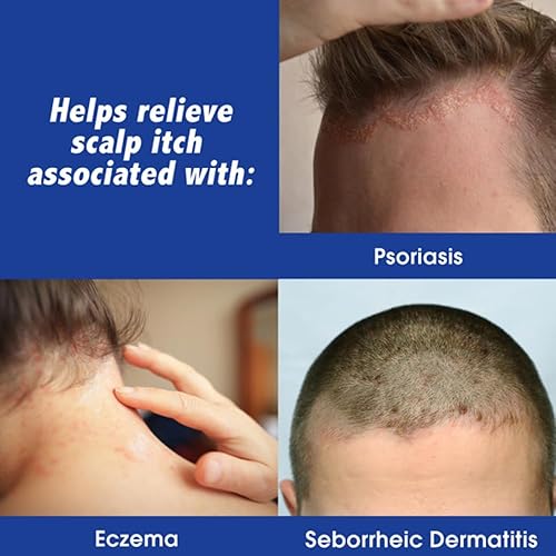 Miniatura 4 de Scalpicin Max Strength - Tratamiento de picazón en el cuero cabelludo, 1.5 onzas (paquete de 4)
