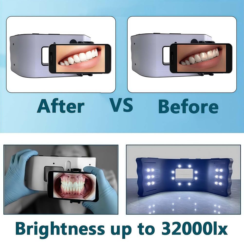 Luz de fotografía dental, luz LED de relleno oral con 20 cuentas de lámpara y diseño de iluminación envolvente 3D, soporte móvil para salón en casa y fotografía macro