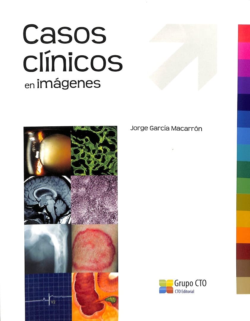 Casos clinicos en imagenes