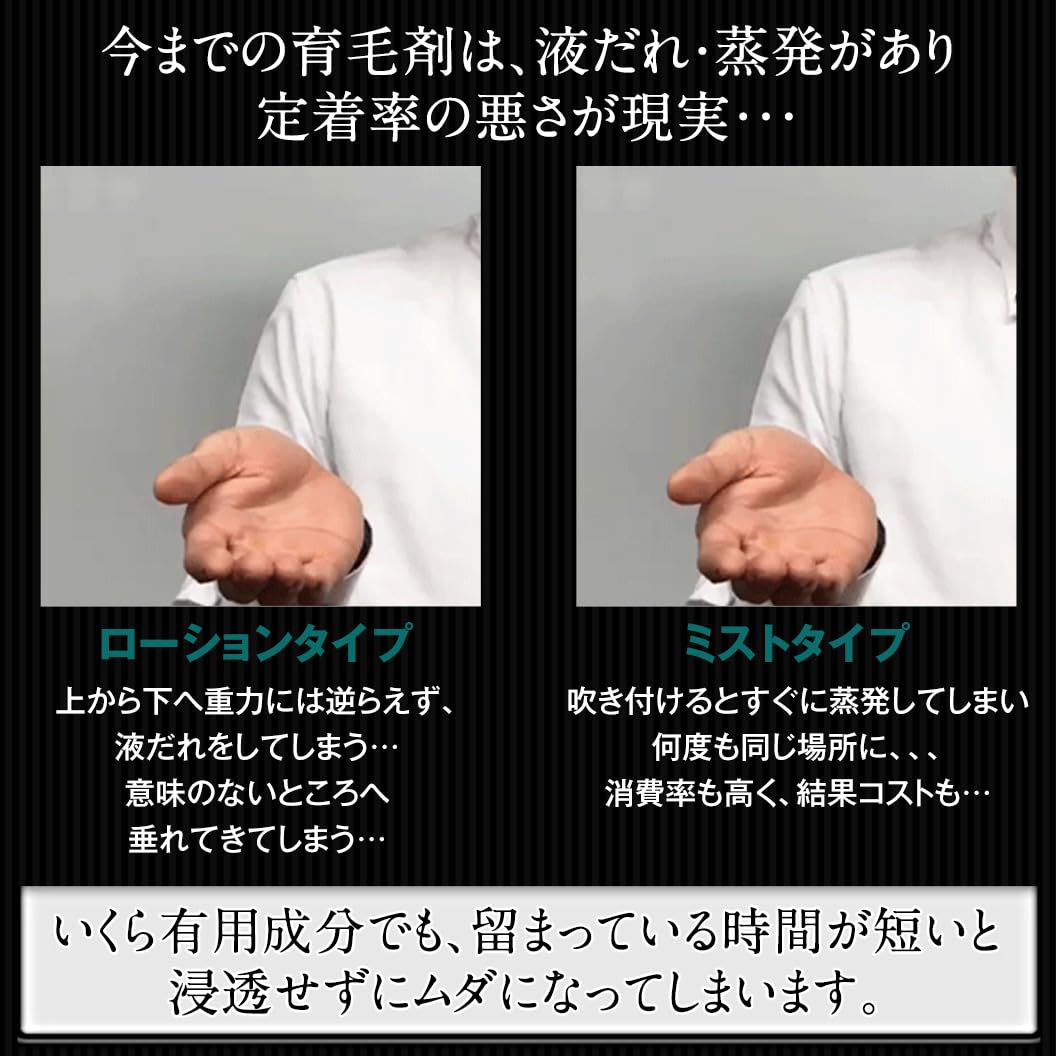 Amazon | 育毛剤 ヘアトニックグロウジェル 医薬部外品 スカルプ ヘア