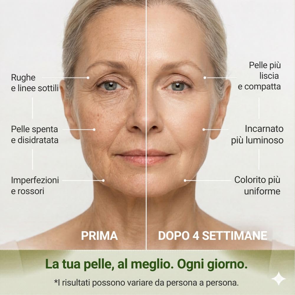 Helix Extra Crema Viso Bava di Lumaca 75% – Antirughe, Antimacchie – Idratante per Pelle Normale, Secca e Matura – Made in Italy 50ml – Confezione Doppia 2 x 50ml