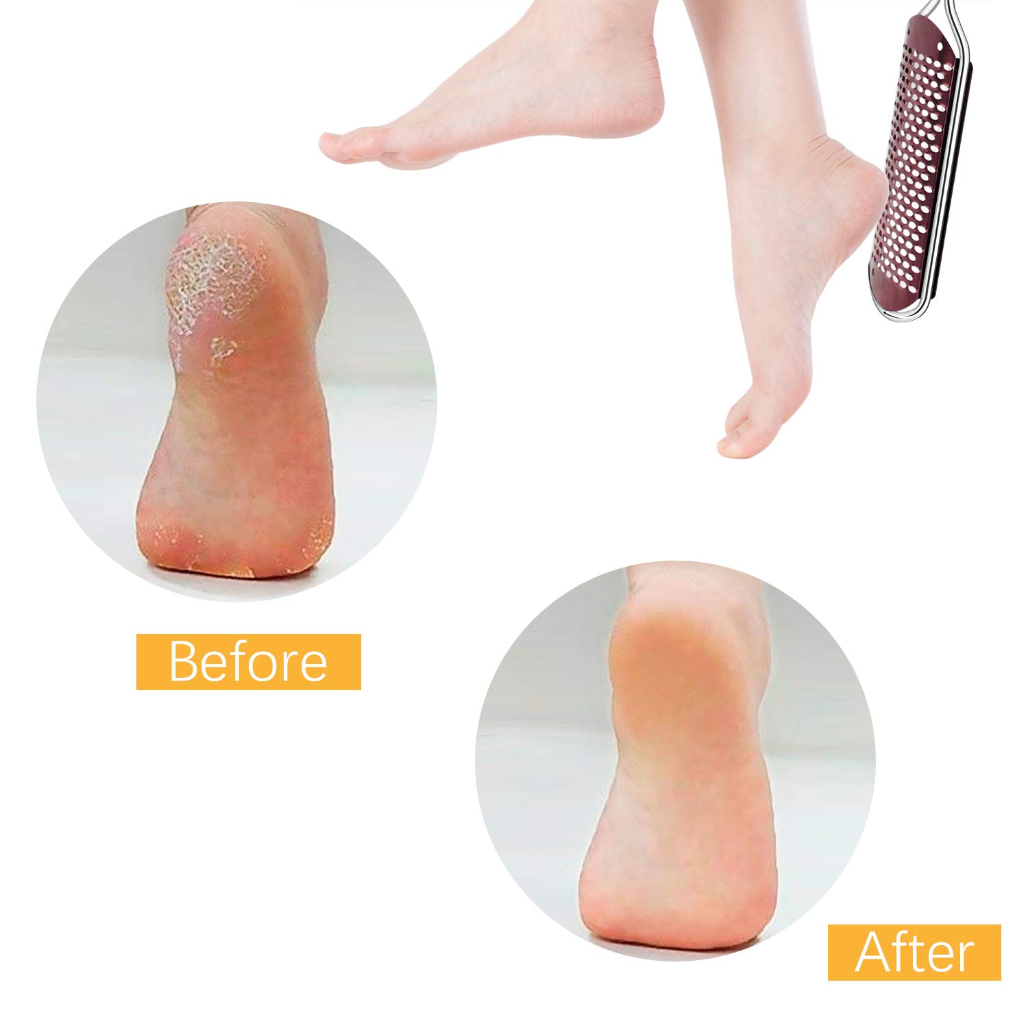 Lima de Pies Premium Removedor de callos para pedicuras - Raspador de pie profesional para el cuidado de los pies Doble cara para eliminar la piel muerta (Oro rosa)