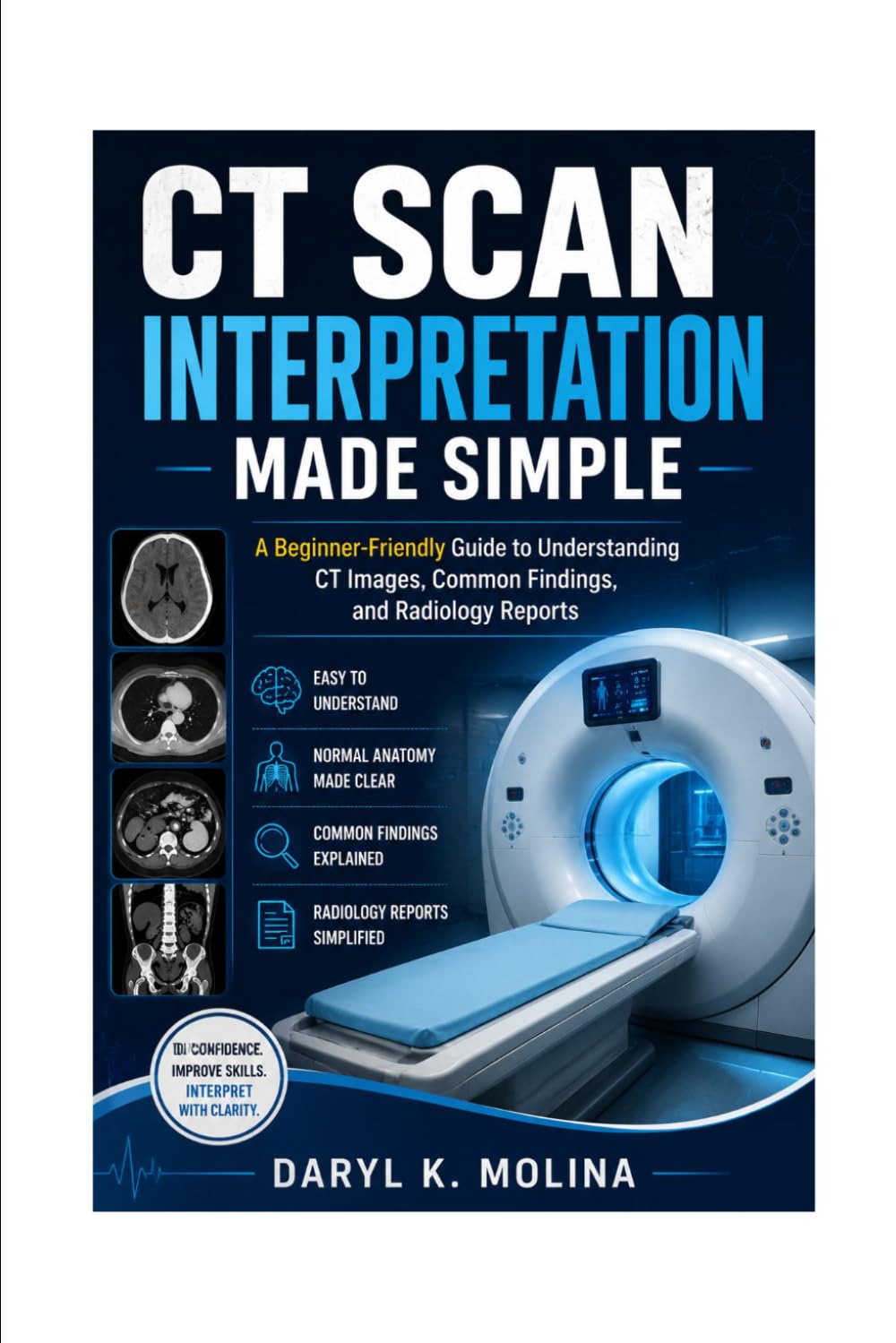 CT SCAN INTERPRETATION MADE SIMPLE: A Beginner-Friendly Guide to Understanding CT Images, Common Findings, and Radiology Reports