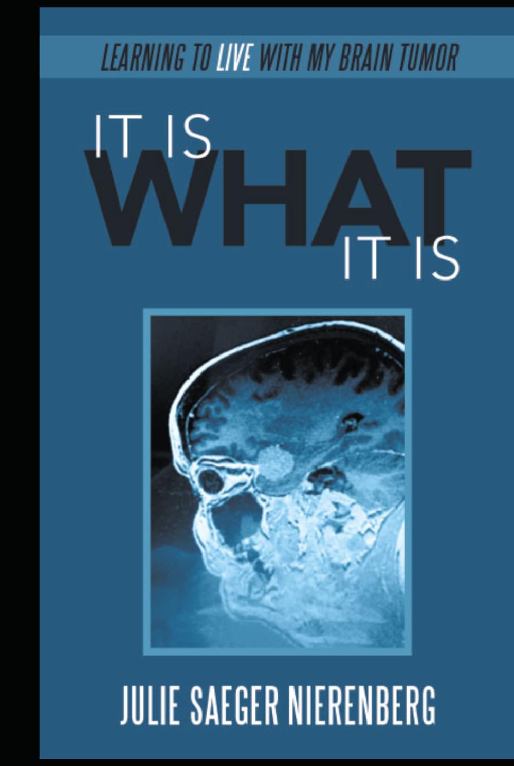 It Is What It Is: Learning to Live with My Brain Tumor