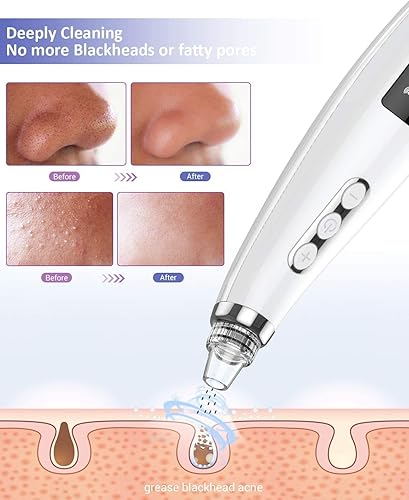 Miniatura 3 de Aspirador de poros de puntos negros, limpiador facial mejorado 2023, limpiador eléctrico recargable por USB, extractor de puntos blancos con 5