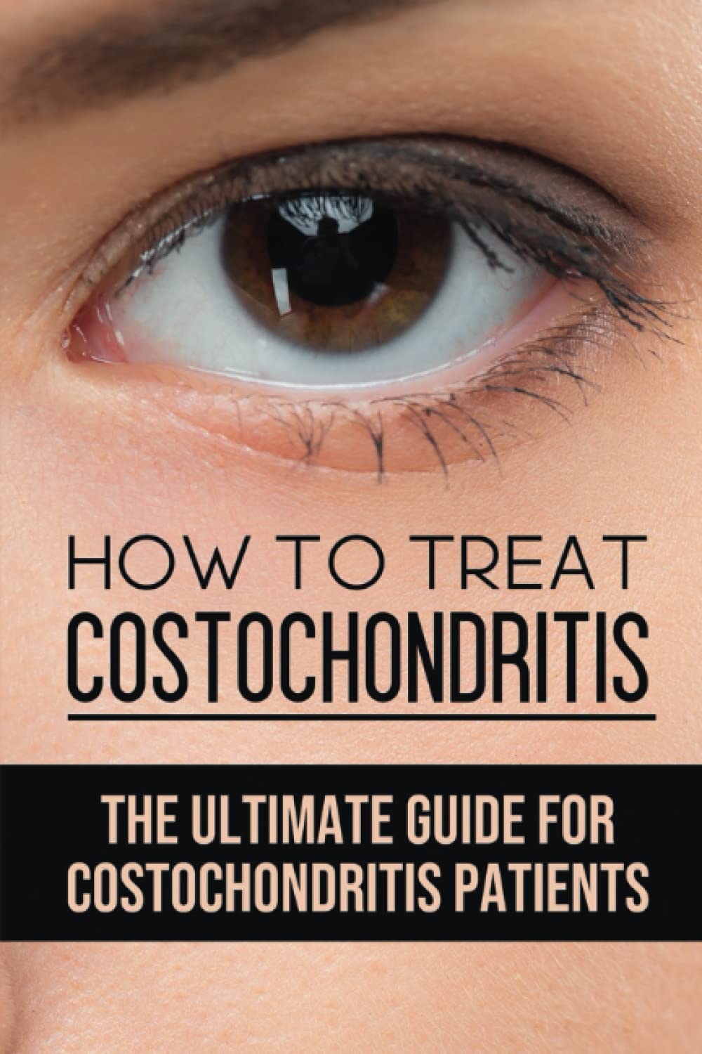 Buy How To Treat Costochondritis The Ultimate Guide For