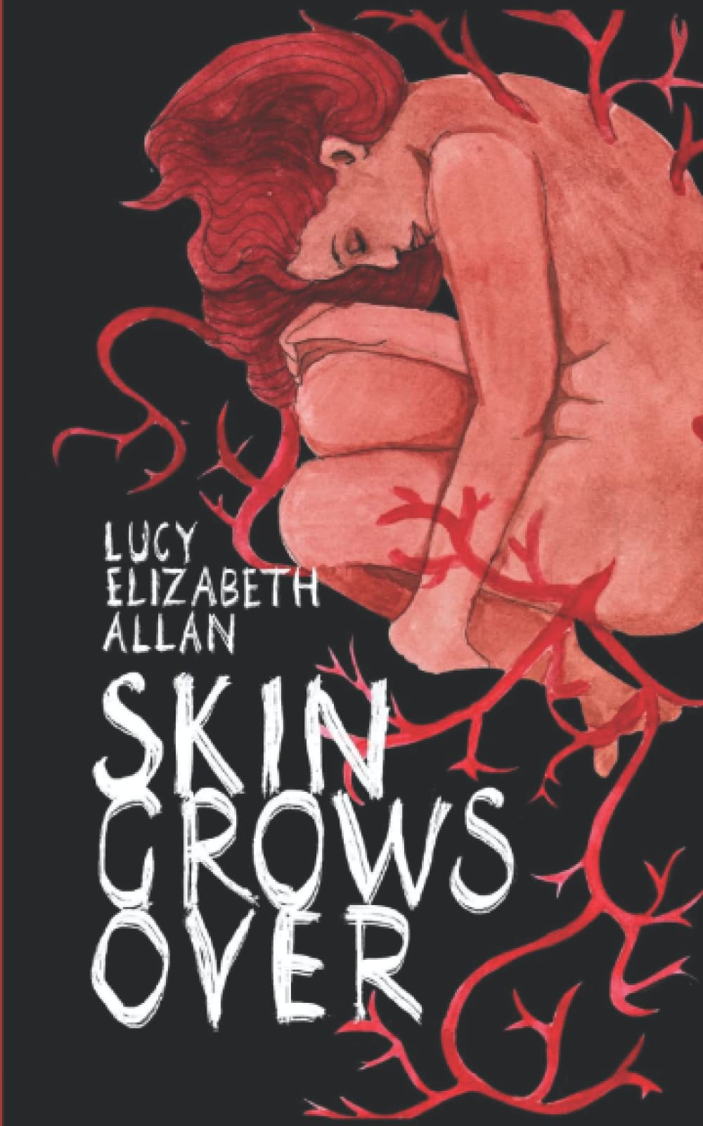 Cover of Skin Grows Over