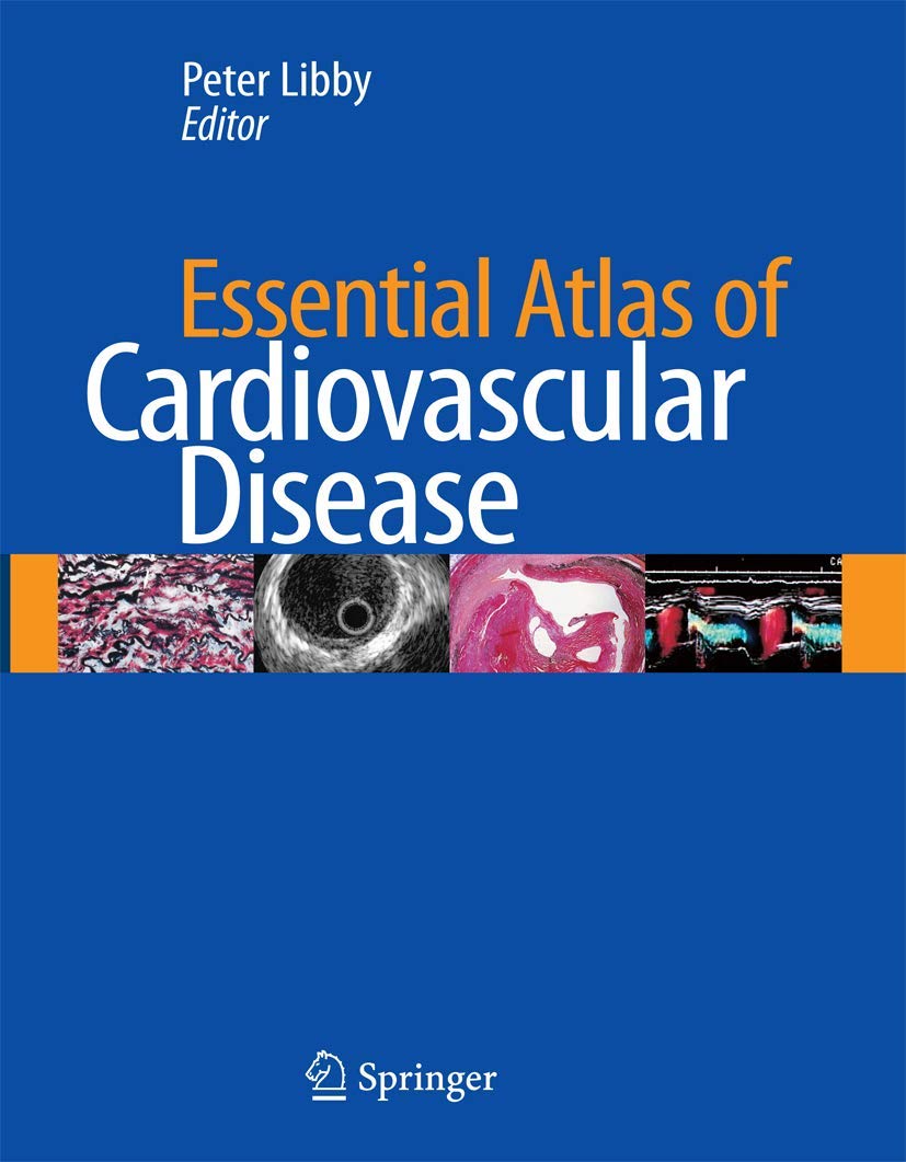[ POPULAR BOOK ] Essential Atlas of Cardiovascular Disease