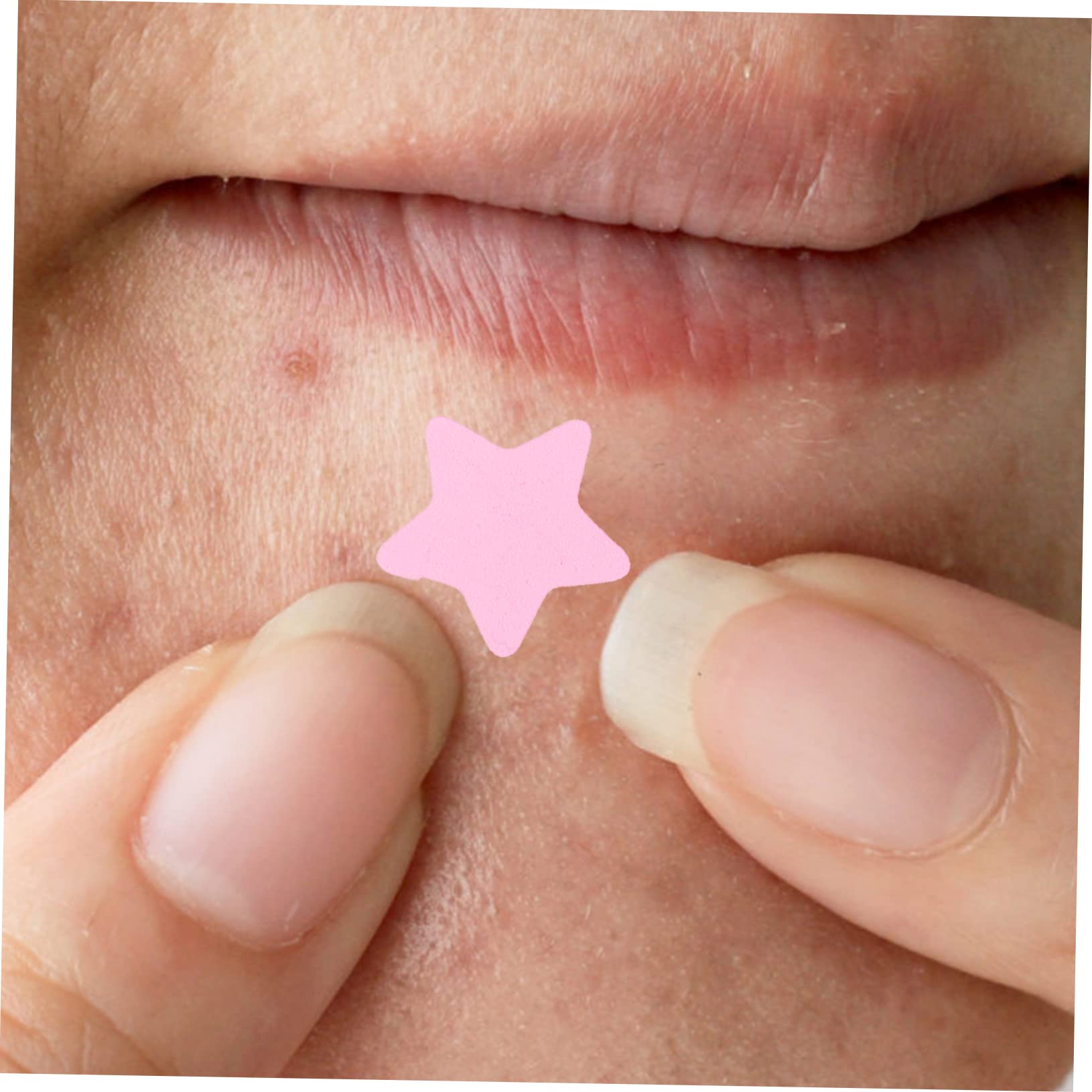 Ipetboom 20hojas Parches Hidrocoloides Transpirables Para Acné Parches Para Espinillas Diseño De Para Facial y Cuidado De Cicatrices