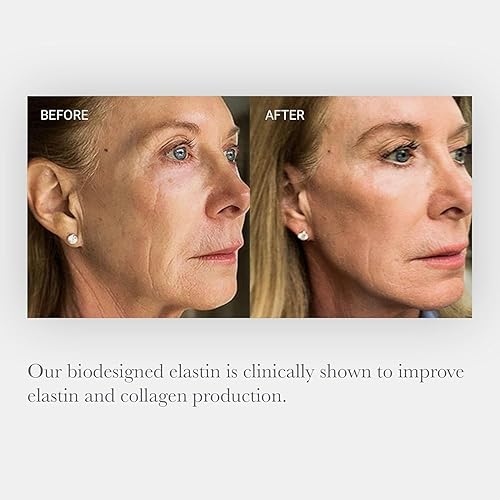 Miniatura 3 de NULASTIN SKIN - Suero facial hidratante intensivo con Elastaplex y ácido hialurónico para piel envejecida, vegano y libre de crueldad (0.5 onzas)