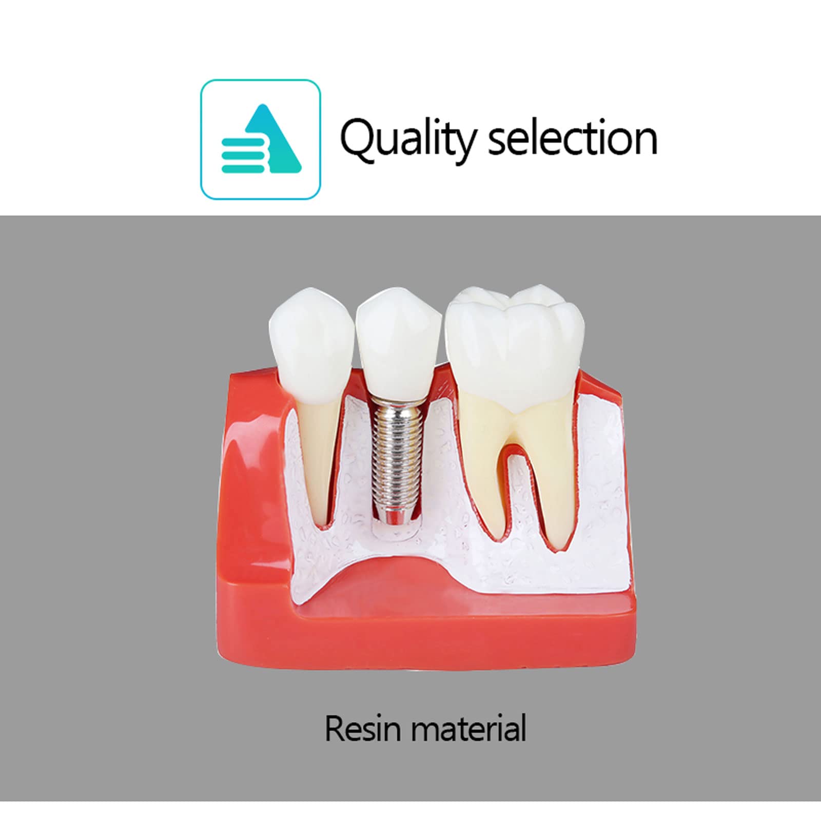 Modello di Denti Analisi, Modello Dentale per Dimostrazione dello Strumento di Insegnamento Dentale in Studio,Denti Analisi Impianto per L'insegnamento e Ricerca Odontoiatrica