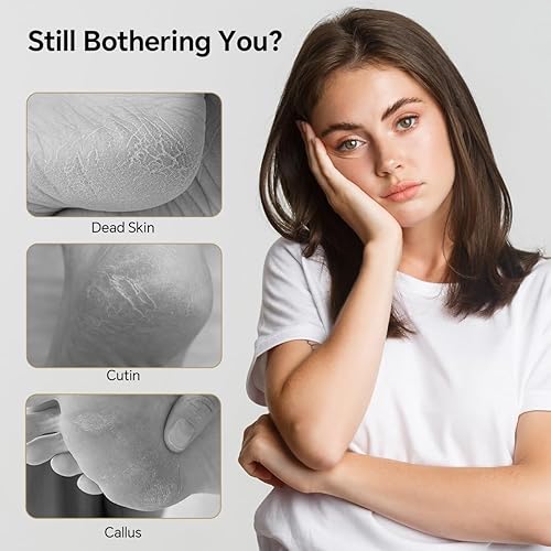 Miniatura 3 de Lima de pie de nanocristal, removedor de callos de pies, herramientas de pedicura de doble cara para pies, doble uso de seco y húmedo, limpiador
