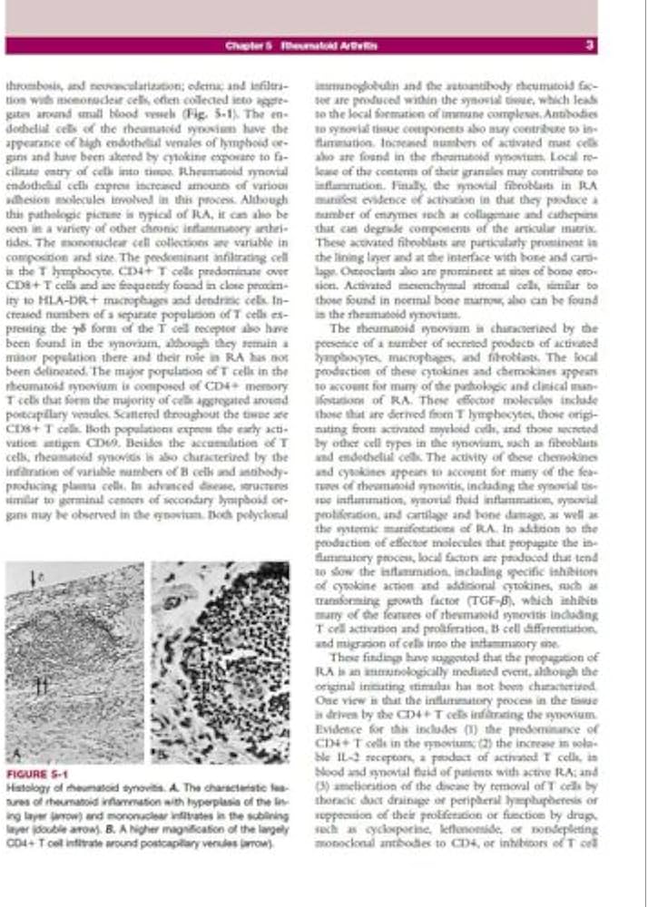 Harrison's Rheumatology: 0000071457437: Medicine & Health Science