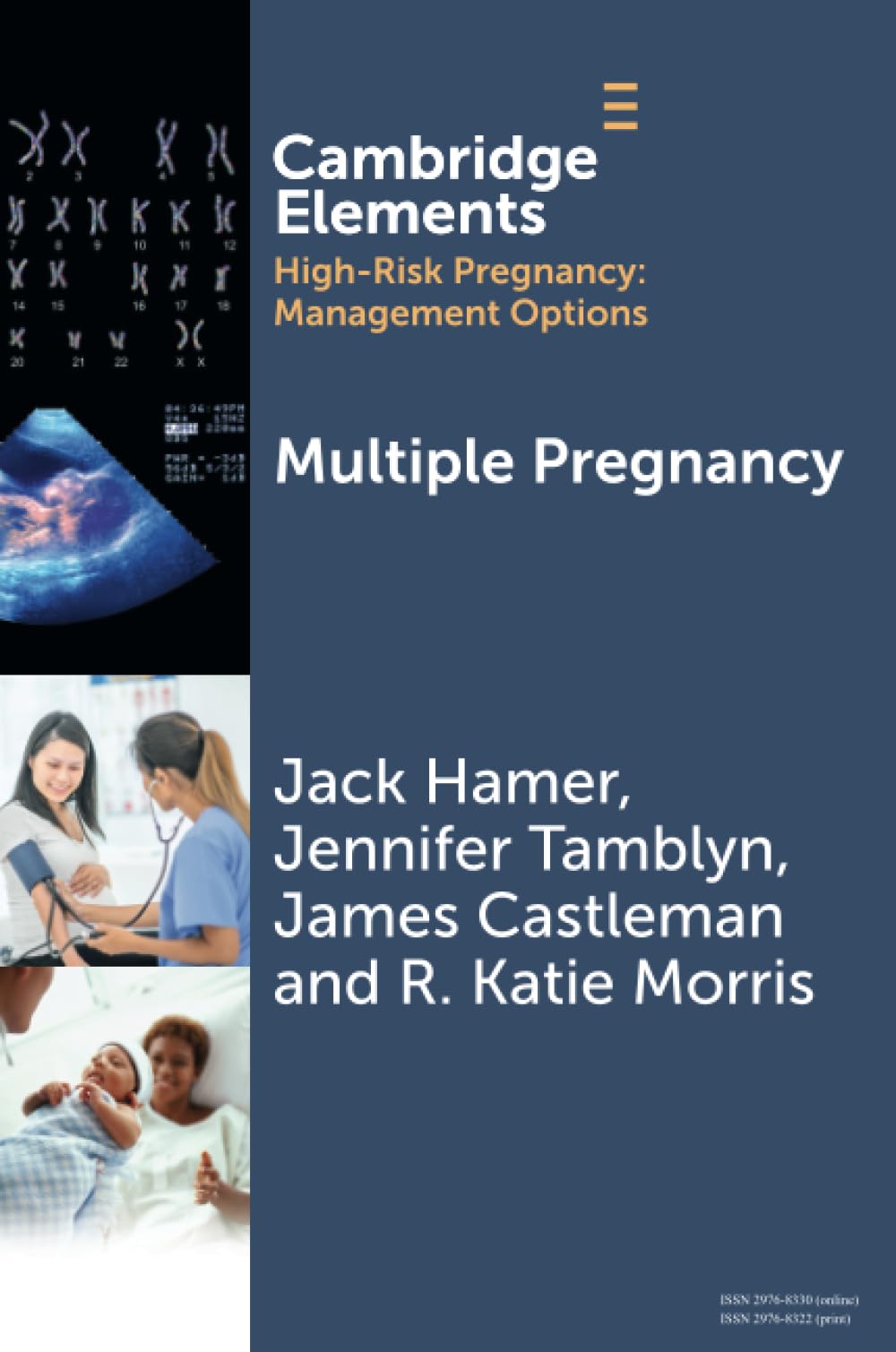 Multiple Pregnancy (Elements in High Risk Pregnancy: Management Options)