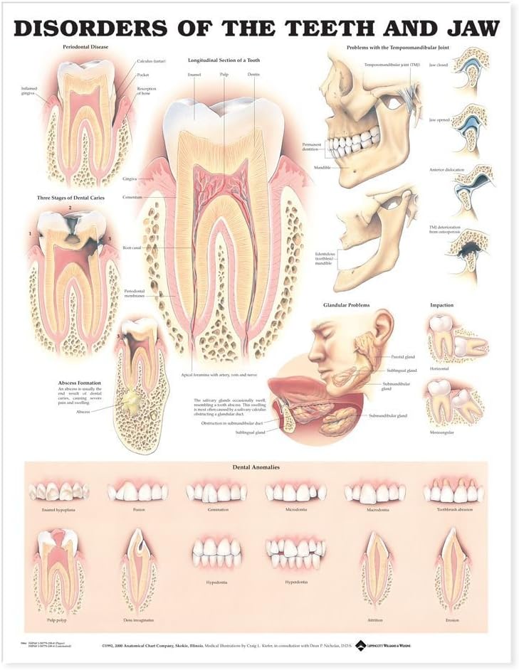 Disorders of the Teeth and Jaw Anatomical Chart