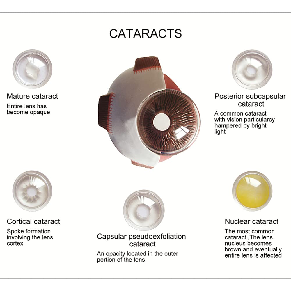 Modello di bulbo oculare della cornea Modello dell'occhio umano Dimostrazione dell'occhio umano Insegnamento Puntello di Cataratta Anatomia Modello di insegnamento medico